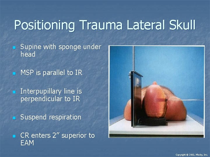 Positioning Trauma Lateral Skull n n n Supine with sponge under head MSP is Positioning Trauma Lateral Skull n n n Supine with sponge under head MSP is