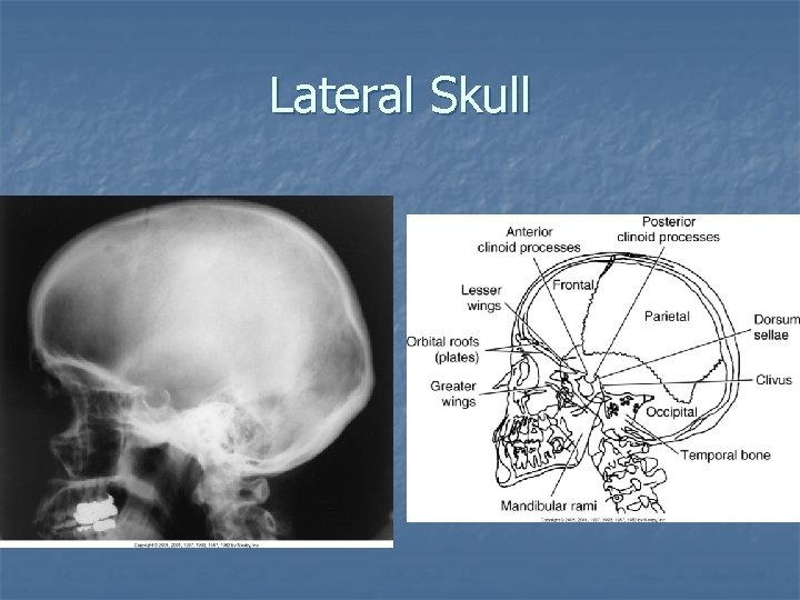 Lateral Skull Lateral Skull
