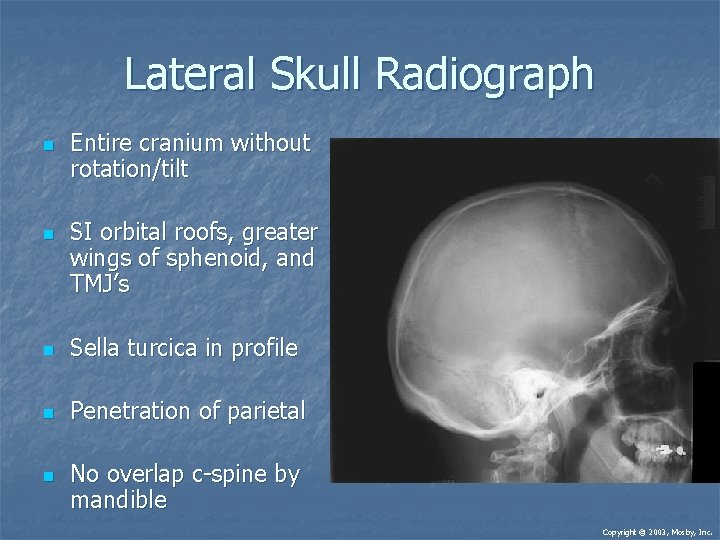 Lateral Skull Radiograph n n Entire cranium without rotation/tilt SI orbital roofs, greater wings Lateral Skull Radiograph n n Entire cranium without rotation/tilt SI orbital roofs, greater wings