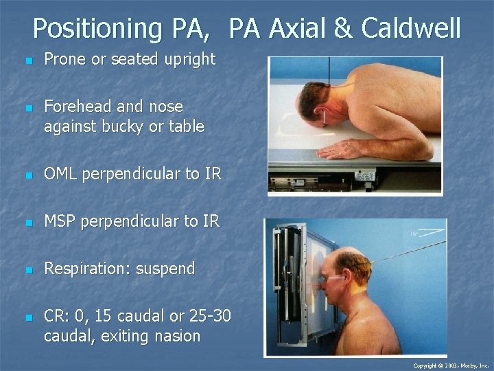 Positioning PA, PA Axial & Caldwell n n Prone or seated upright Forehead and Positioning PA, PA Axial & Caldwell n n Prone or seated upright Forehead and