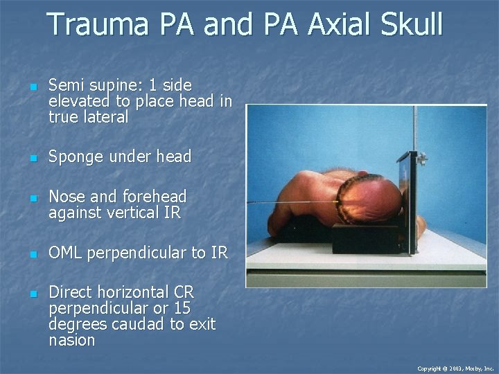 Trauma PA and PA Axial Skull n Semi supine: 1 side elevated to place Trauma PA and PA Axial Skull n Semi supine: 1 side elevated to place