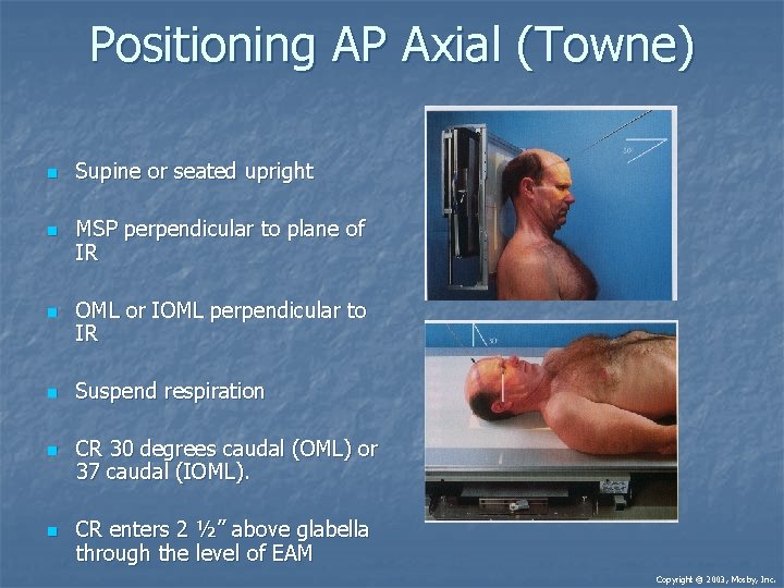 Positioning AP Axial (Towne) n n n Supine or seated upright MSP perpendicular to Positioning AP Axial (Towne) n n n Supine or seated upright MSP perpendicular to