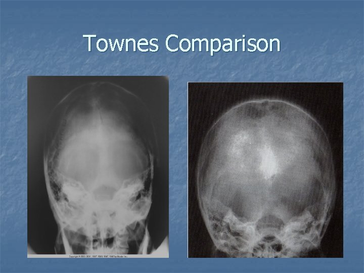 Townes Comparison Townes Comparison