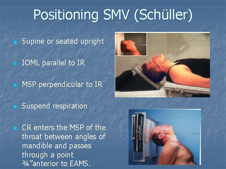 Positioning SMV (Schüller) n Supine or seated upright n IOML parallel to IR n Positioning SMV (Schüller) n Supine or seated upright n IOML parallel to IR n