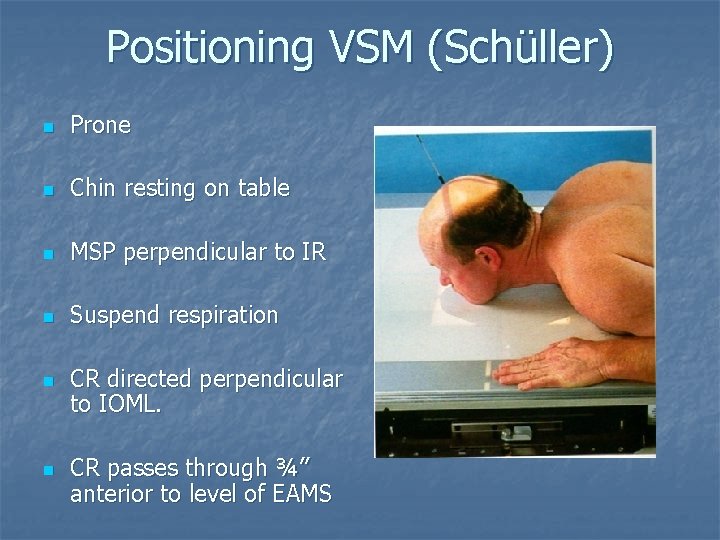 Positioning VSM (Schüller) n Prone n Chin resting on table n MSP perpendicular to Positioning VSM (Schüller) n Prone n Chin resting on table n MSP perpendicular to