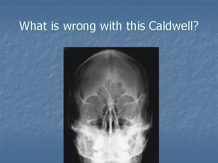 What is wrong with this Caldwell? What is wrong with this Caldwell?