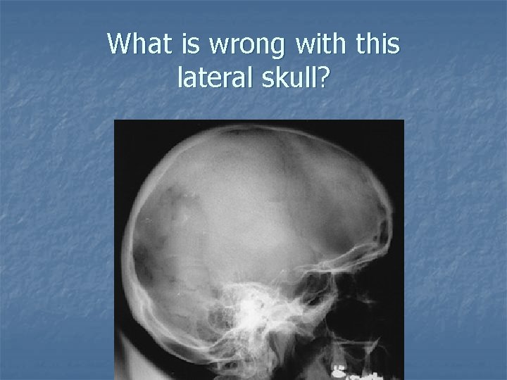 What is wrong with this lateral skull? What is wrong with this lateral skull?