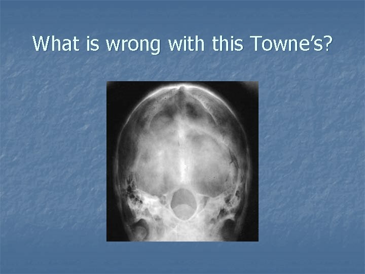 What is wrong with this Towne’s? What is wrong with this Towne’s?