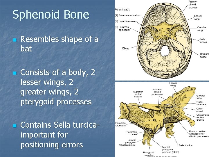 Sphenoid Bone n n n Resembles shape of a bat Consists of a body, Sphenoid Bone n n n Resembles shape of a bat Consists of a body,