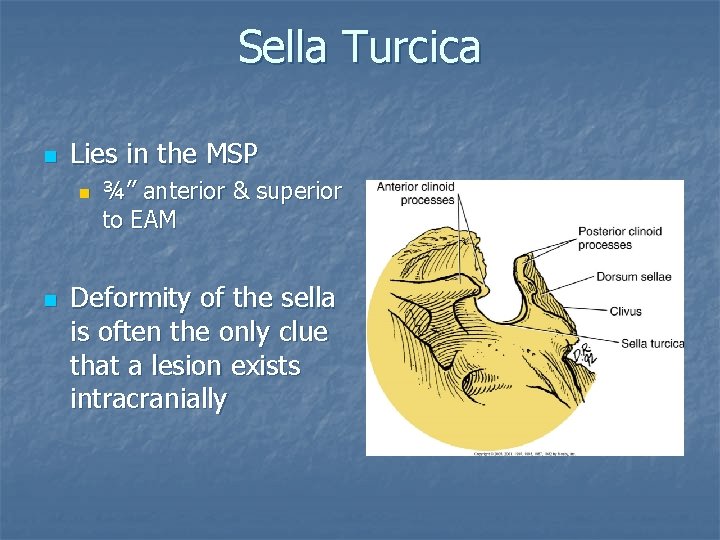 Sella Turcica n Lies in the MSP n n ¾” anterior & superior to Sella Turcica n Lies in the MSP n n ¾” anterior & superior to