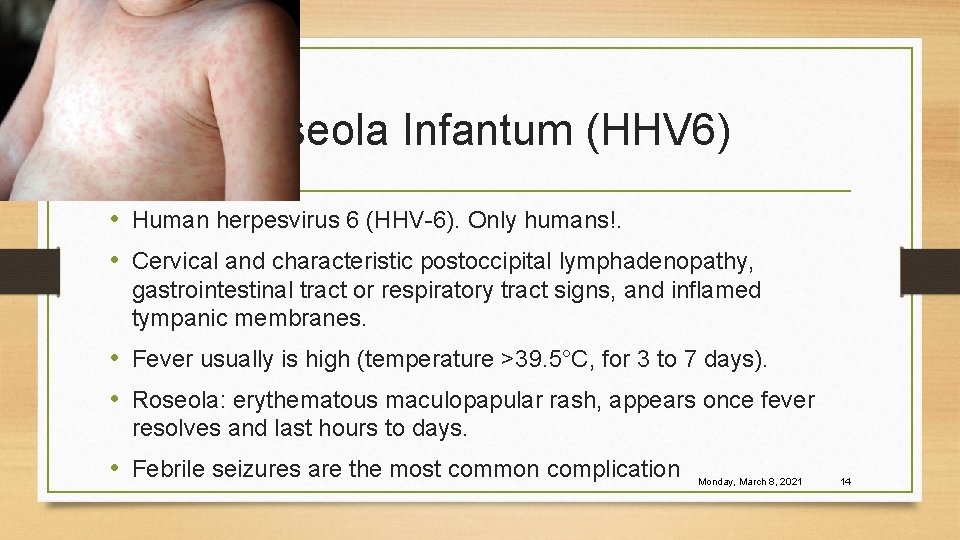 Roseola Infantum (HHV 6) • Human herpesvirus 6 (HHV-6). Only humans!. • Cervical and