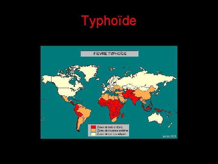 Typhoïde 