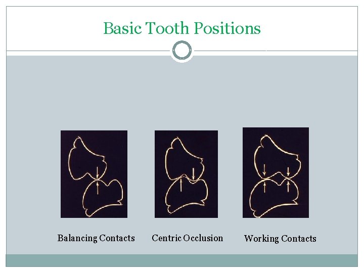 Basic Tooth Positions Balancing Contacts Centric Occlusion Working Contacts 