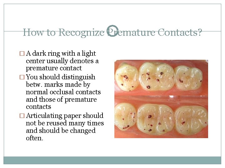 How to Recognize Premature Contacts? � A dark ring with a light center usually