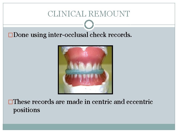 CLINICAL REMOUNT �Done using inter-occlusal check records. �These records are made in centric and