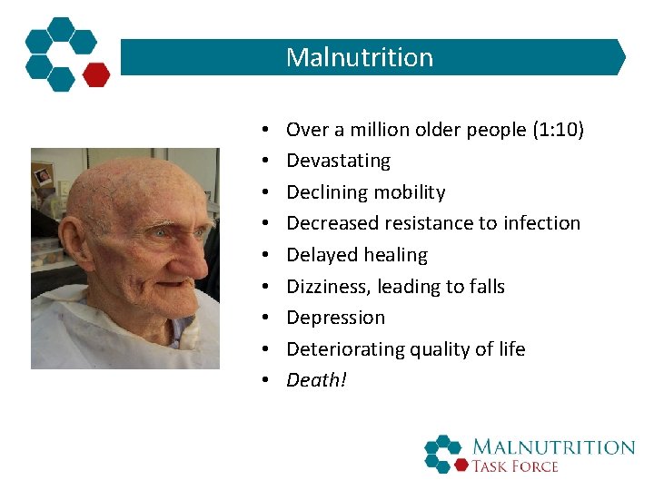 Malnutrition • • • Over a million older people (1: 10) Devastating Declining mobility