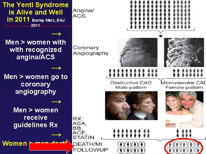 The Yentl Syndrome is Alive and Well in 2011 Bairey Merz, EHJ 2011 →