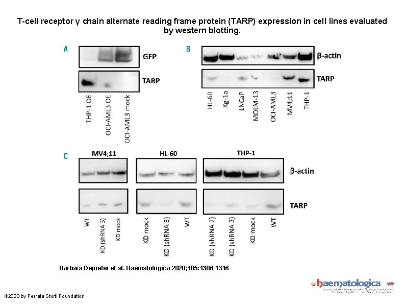 T-cell receptor γ chain alternate reading frame protein (TARP) expression in cell lines evaluated