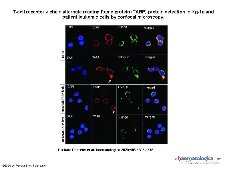 T-cell receptor γ chain alternate reading frame protein (TARP) protein detection in Kg-1 a