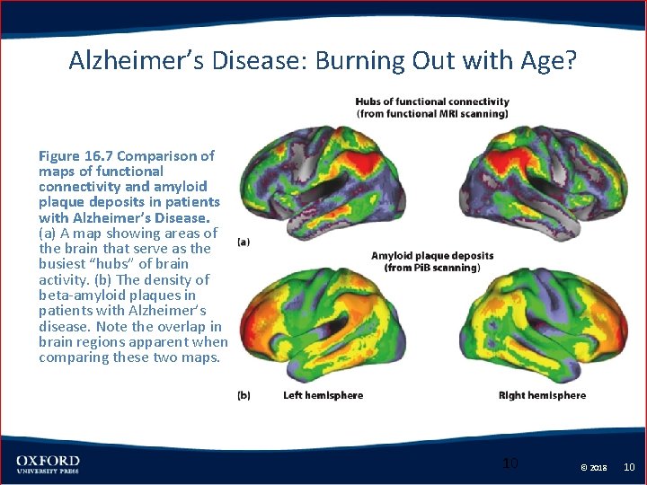 Alzheimer’s Disease: Burning Out with Age? Figure 16. 7 Comparison of maps of functional