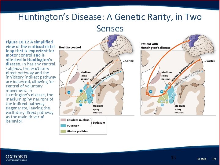 Huntington’s Disease: A Genetic Rarity, in Two Senses Figure 16. 12 A simplified view