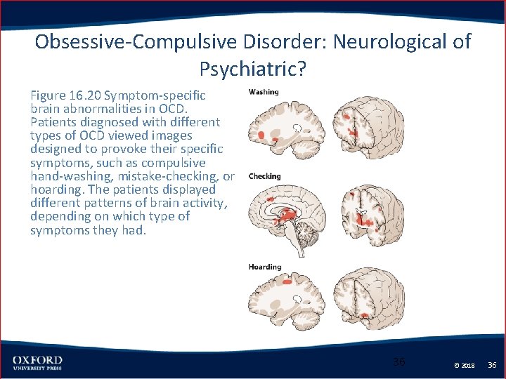 Obsessive-Compulsive Disorder: Neurological of Psychiatric? Figure 16. 20 Symptom-specific brain abnormalities in OCD. Patients