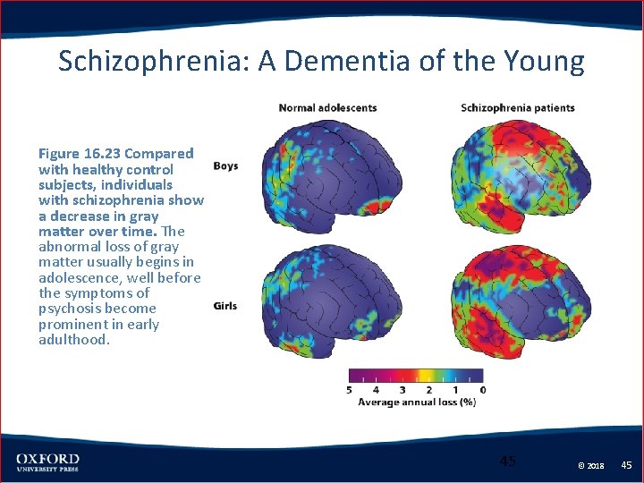 Schizophrenia: A Dementia of the Young Figure 16. 23 Compared with healthy control subjects,