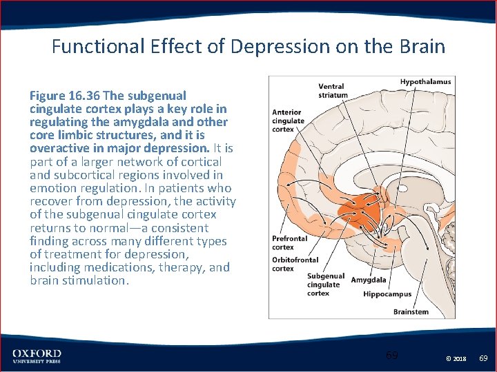 Functional Effect of Depression on the Brain Figure 16. 36 The subgenual cingulate cortex