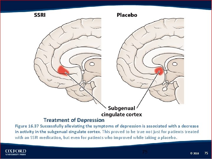 Treatment of Depression Figure 16. 37 Successfully alleviating the symptoms of depression is associated