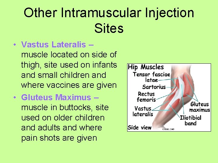 Other Intramuscular Injection Sites • Vastus Lateralis – muscle located on side of thigh,