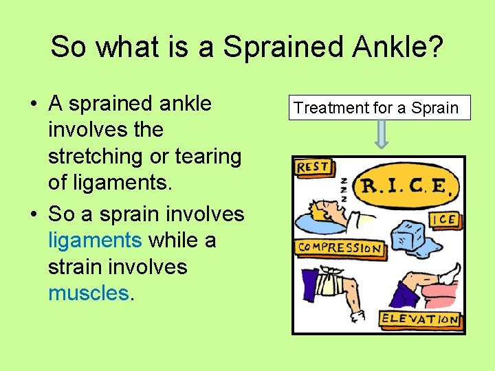 So what is a Sprained Ankle? • A sprained ankle involves the stretching or