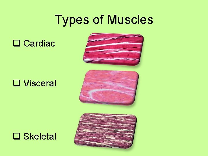 Types of Muscles q Cardiac q Visceral q Skeletal 