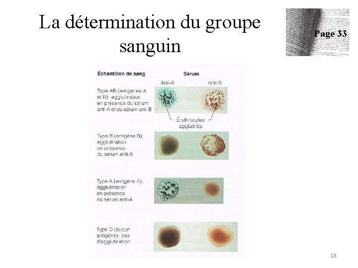La détermination du groupe sanguin Page 33 18 La détermination du groupe sanguin Page 33 18