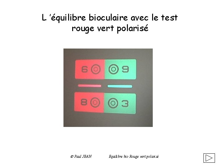 L ’équilibre bioculaire avec le test rouge vert polarisé Paul JEAN Equilibre bio Rouge