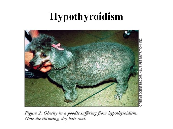 Hypothyroidism 