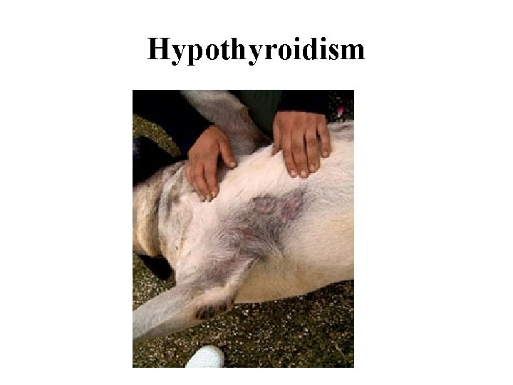 Hypothyroidism 