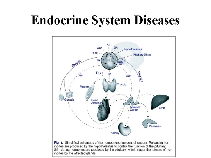 Endocrine System Diseases 