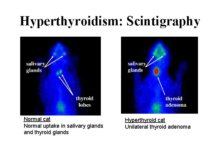 Hyperthyroidism: Scintigraphy Normal cat Normal uptake in salivary glands and thyroid glands Hyperthyroid cat