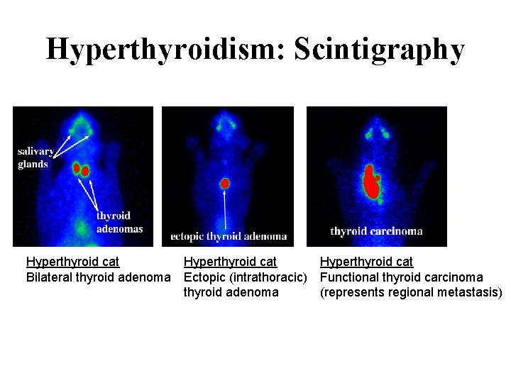 Hyperthyroidism: Scintigraphy Hyperthyroid cat Bilateral thyroid adenoma Hyperthyroid cat Ectopic (intrathoracic) thyroid adenoma Hyperthyroid
