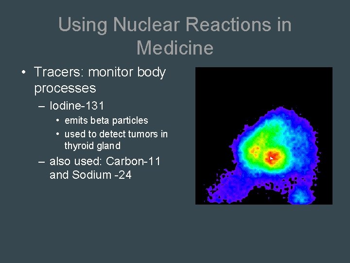 Using Nuclear Reactions in Medicine • Tracers: monitor body processes – Iodine-131 • emits