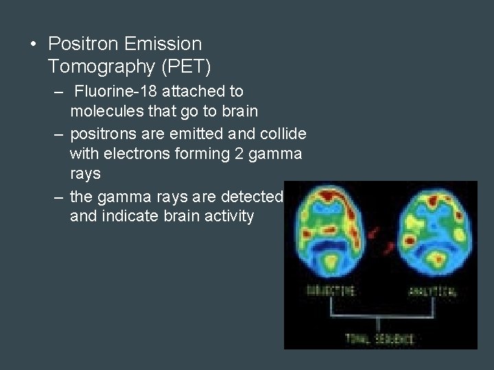  • Positron Emission Tomography (PET) – Fluorine-18 attached to molecules that go to