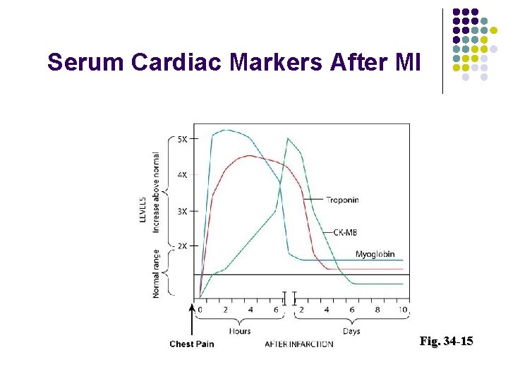 Serum Cardiac Markers After MI Fig. 34 -15 