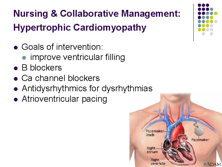 Nursing & Collaborative Management: Hypertrophic Cardiomyopathy l l l Goals of intervention: l improve