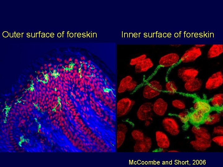 Outer surface of foreskin Inner surface of foreskin Mc. Coombe and Short, 2006 