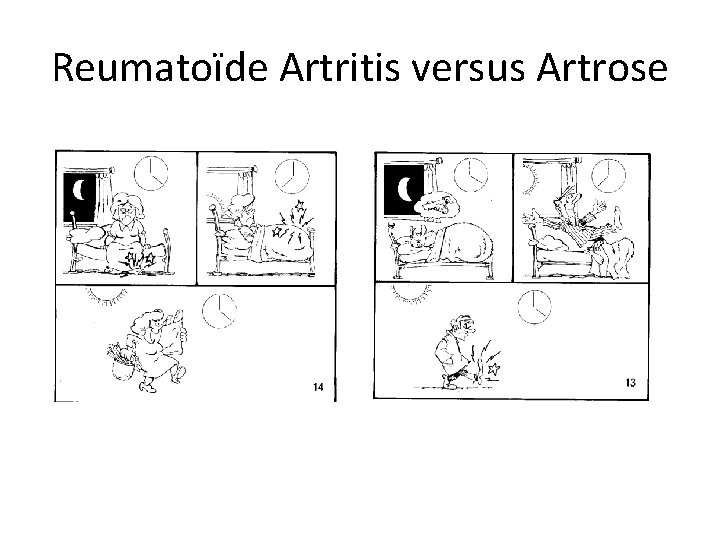 Reumatoïde Artritis versus Artrose 