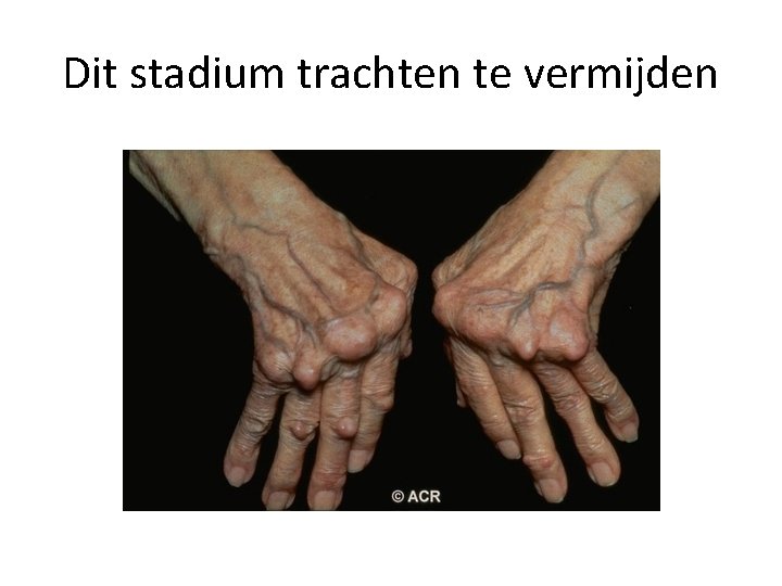 Dit stadium trachten te vermijden 