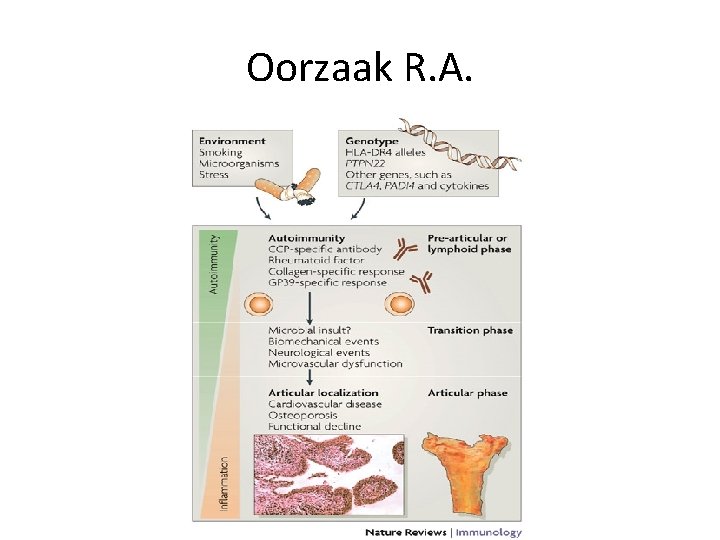 Oorzaak R. A. 