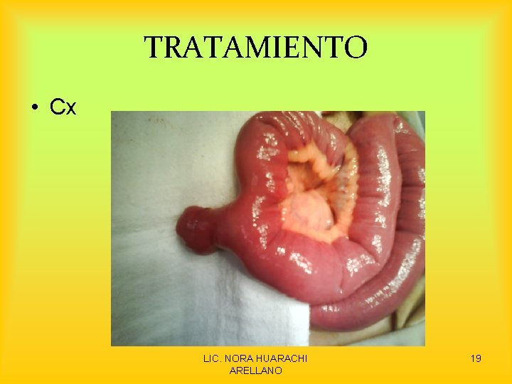 TRATAMIENTO • Cx LIC. NORA HUARACHI ARELLANO 19 