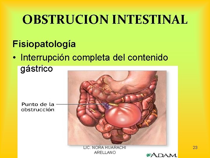 OBSTRUCION INTESTINAL Fisiopatología • Interrupción completa del contenido gástrico LIC. NORA HUARACHI ARELLANO 23