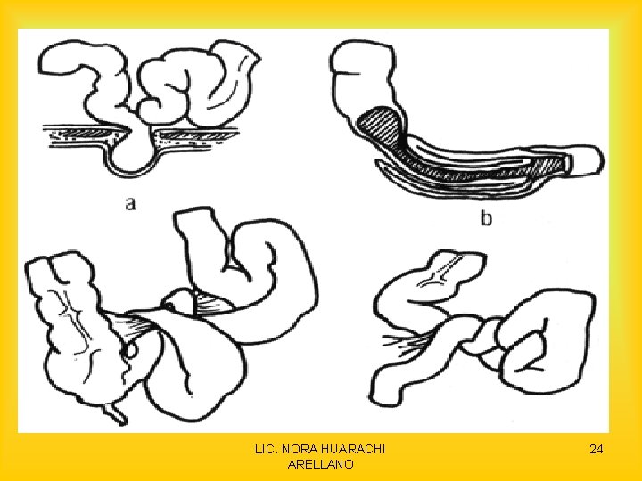 LIC. NORA HUARACHI ARELLANO 24 